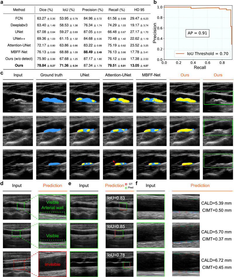 41467 2025 62865 Fig8 HTML