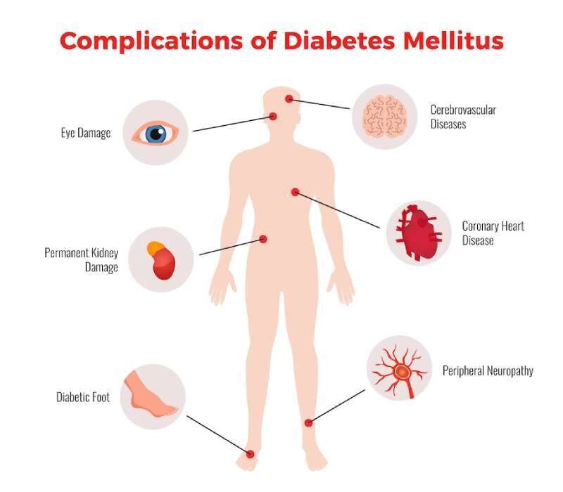 DiabeteComplications