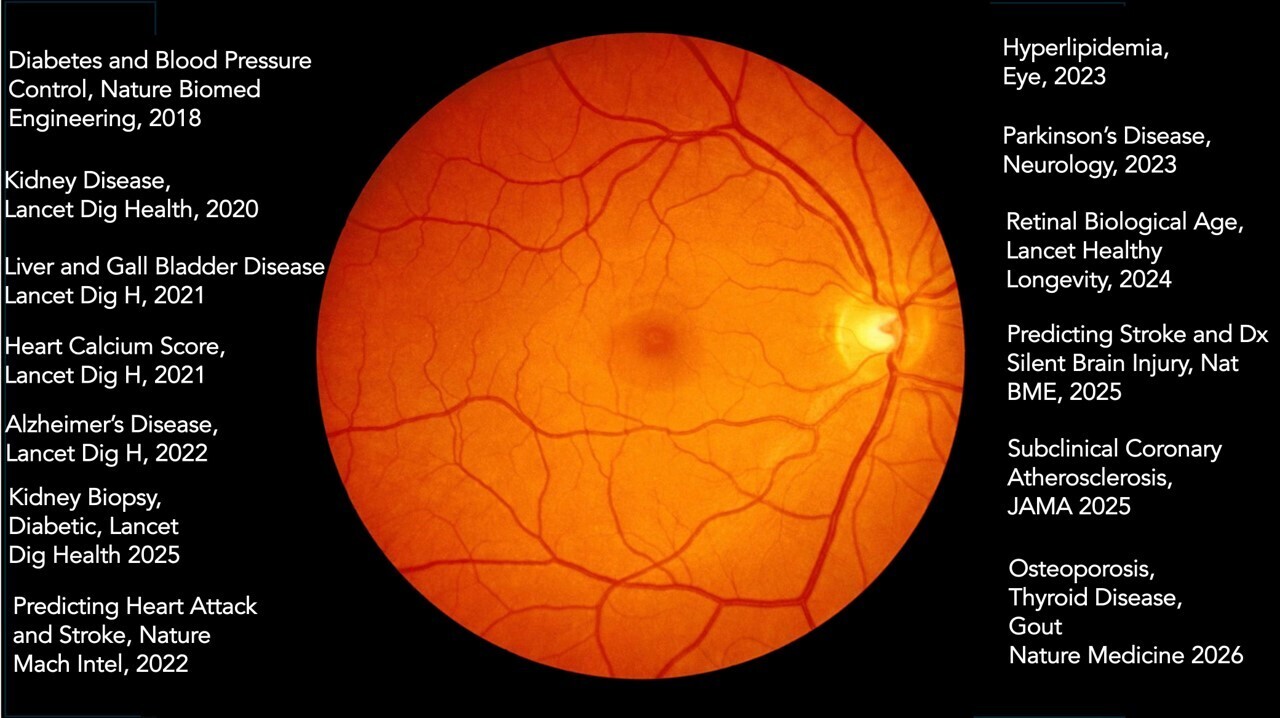 OEIL