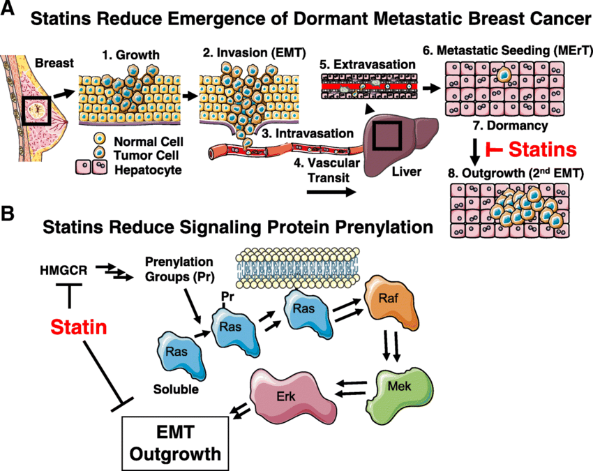 Proposed model for statin action in breast cancer a The breast cancer metastatic