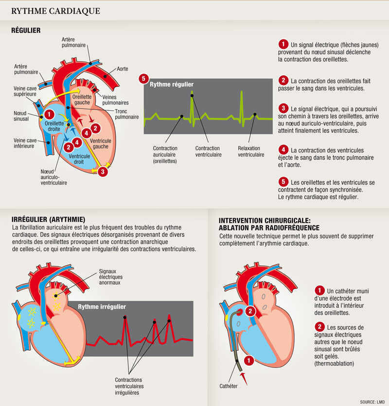 arythmies infog ng responsive full