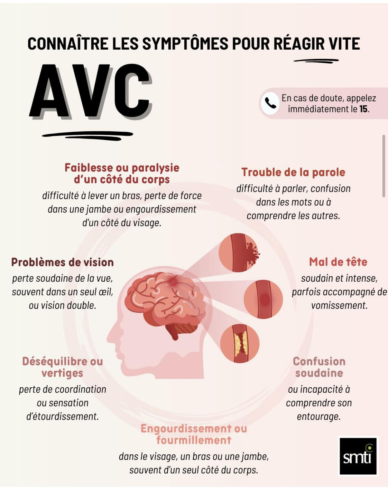 avvcc