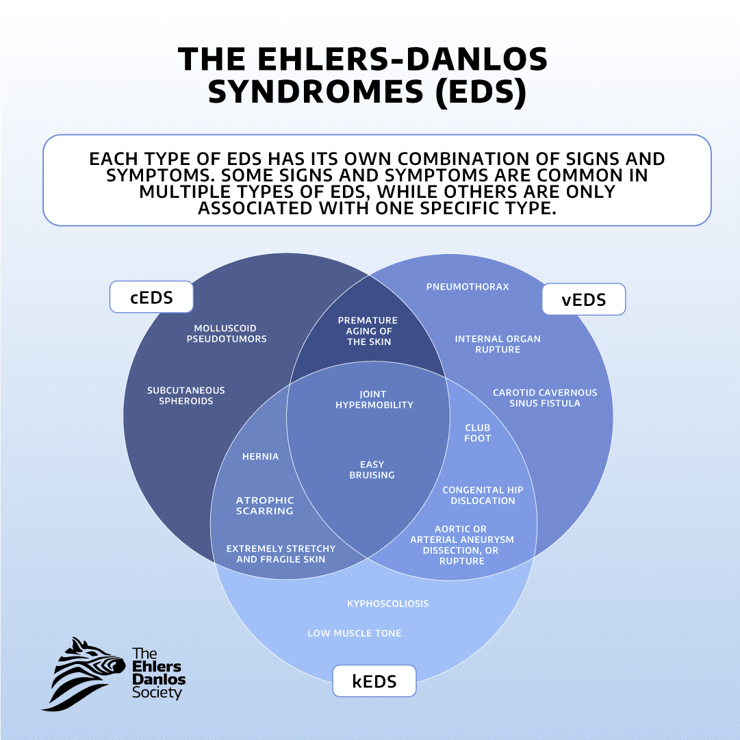 eds spectrum venn graphic
