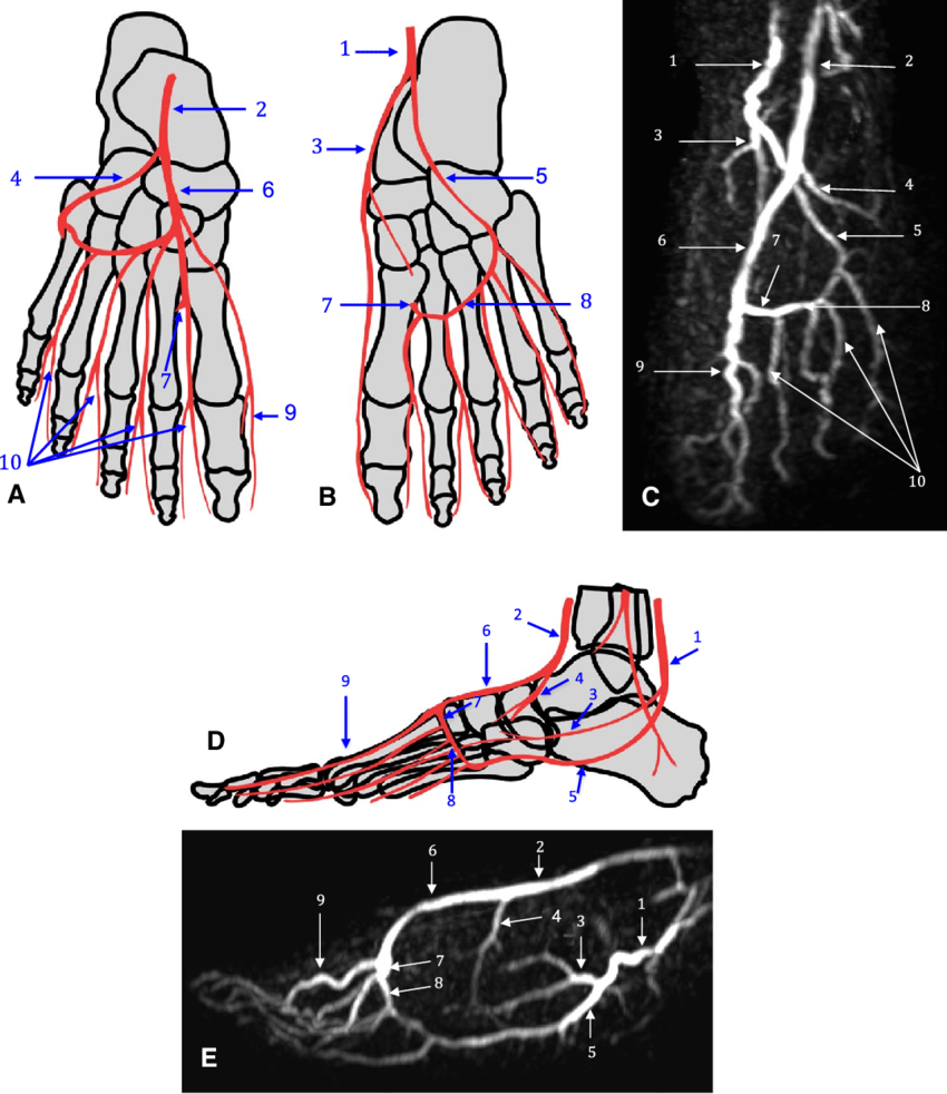 llustration of pedal artery anatomy a b d and MIP images of FS FBI c e a b d