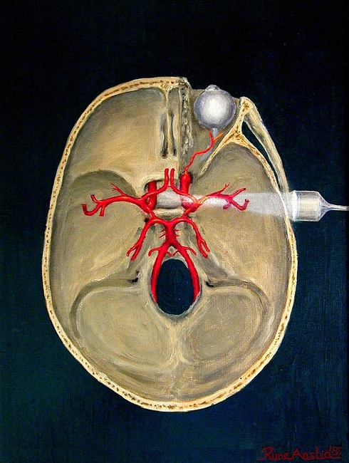 800px Transcranial doppler