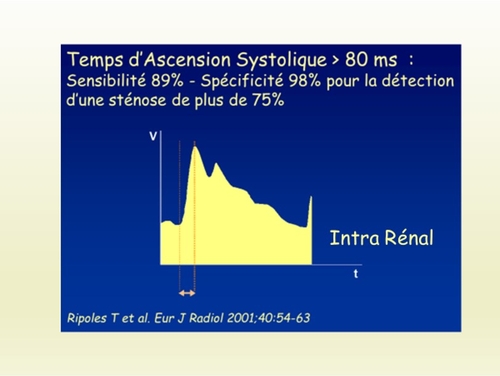 Temps d'Ascension Systolique !