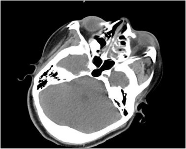 MUCOR10