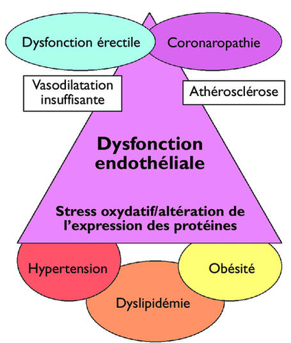 La dysfonction érectile précède une événement cardio-vasculaire