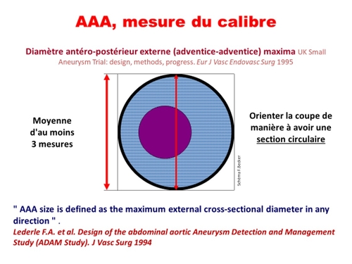 Traitement "médical "de l'AAA