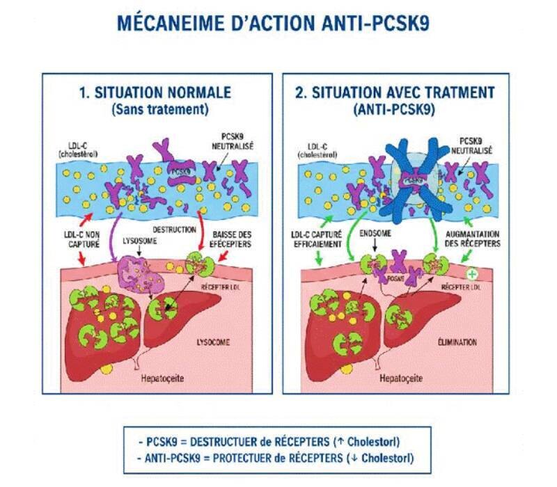 AntiPCSK9 : revue