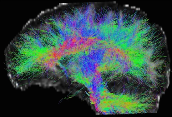 Manifestations neurologiques et Covid-19