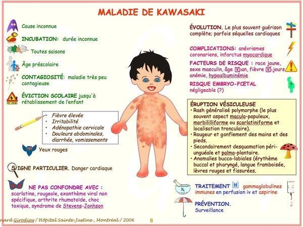 COVID-19 :  enfants et KAWASAKI ? 