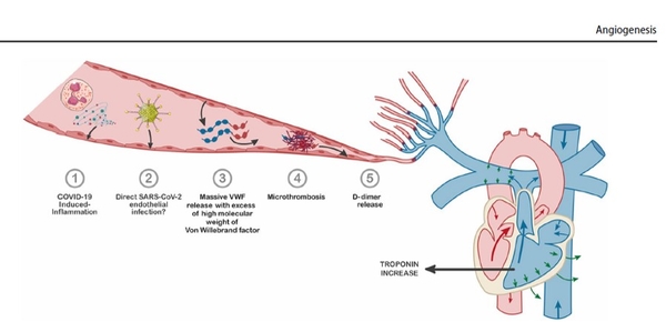 microthrombosr